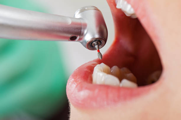 Best Pediatric Emergency Dentist in Jourdanton, TX